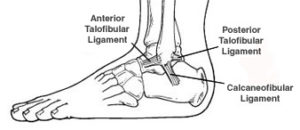 ankle sprain